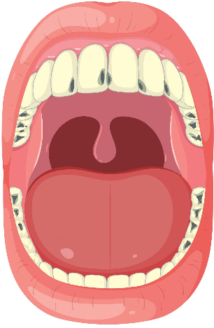 Frenectomy